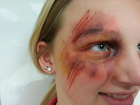 Eye bruising for FX class